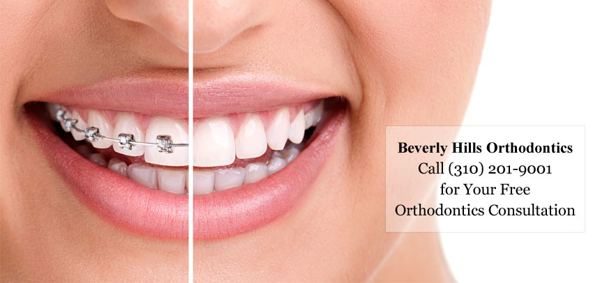 Beverly Hills Orthodontics