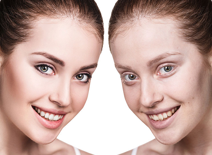 Beverly Hills Anti Aging Dentistry