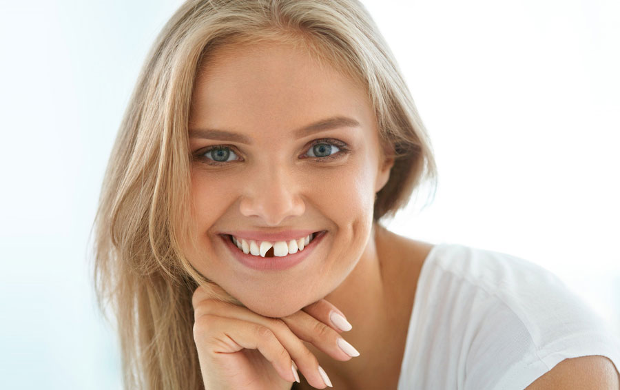 chipped tooth treatment
