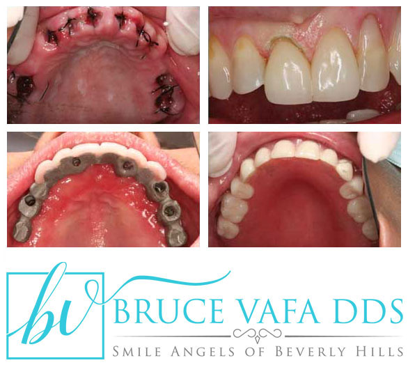 Beverly Hills cosmetic dentist