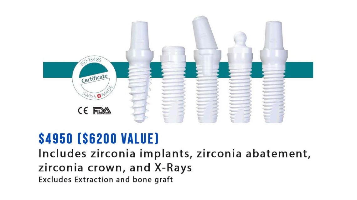 Zirconia dental implants Los Angeles