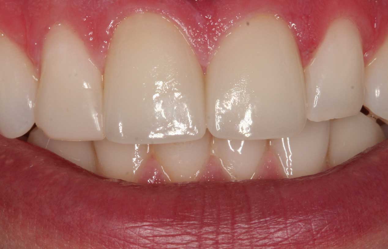 Holistic dental treatment