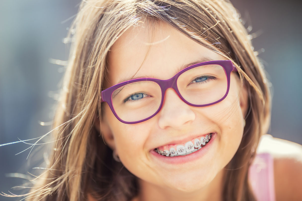 How Much Do Braces Cost in Beverly Hills? - Smile Angels of Beverly Hills