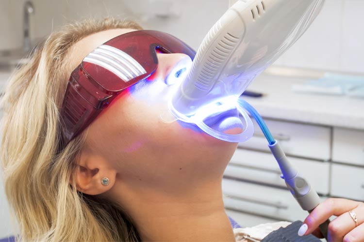 Teeth Whitening Los Angeles