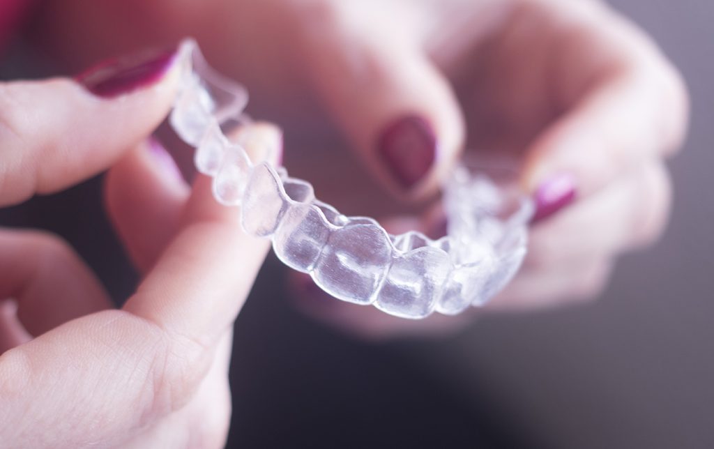 at home teeth straightening