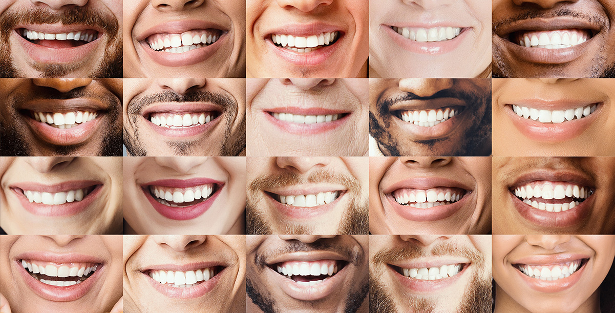 teeth whitening candidates