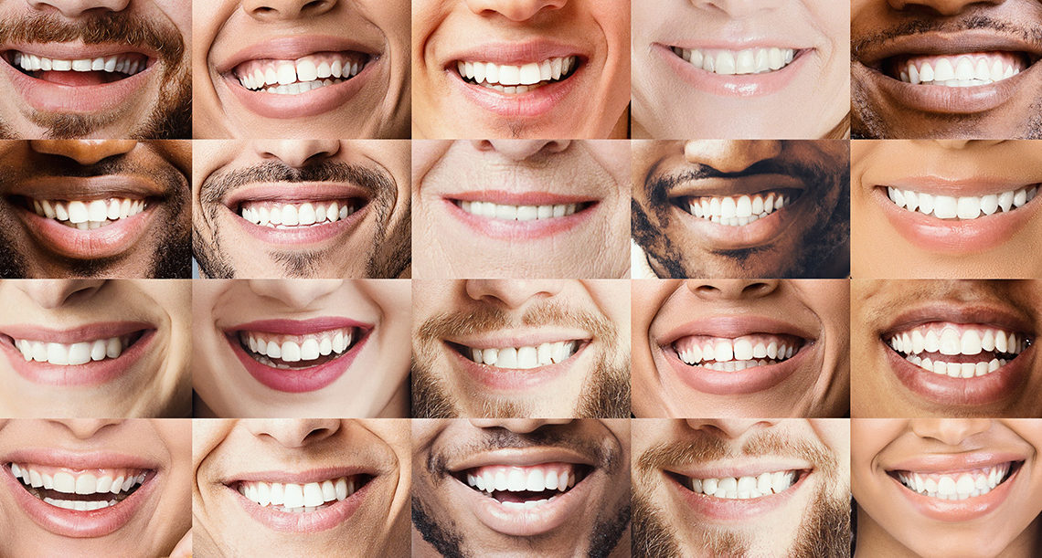 teeth whitening candidates