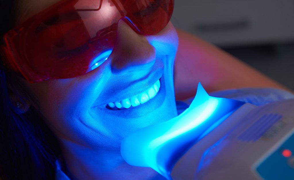teeth whitening procedure