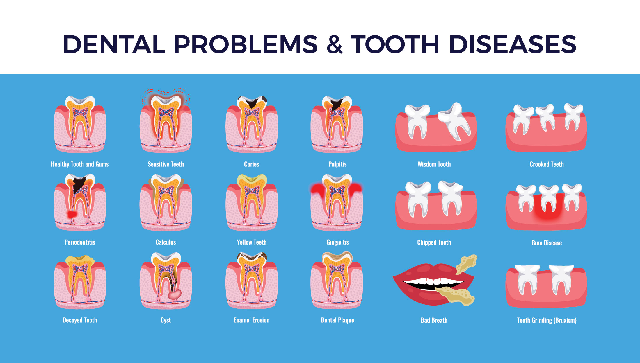 Dental Diseases Disorders Chart Oral Health Poster Vrogue Co
