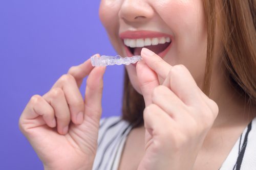 Invisalign
