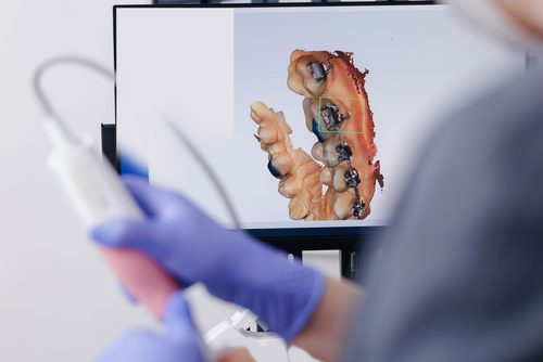 3D Dental Scans